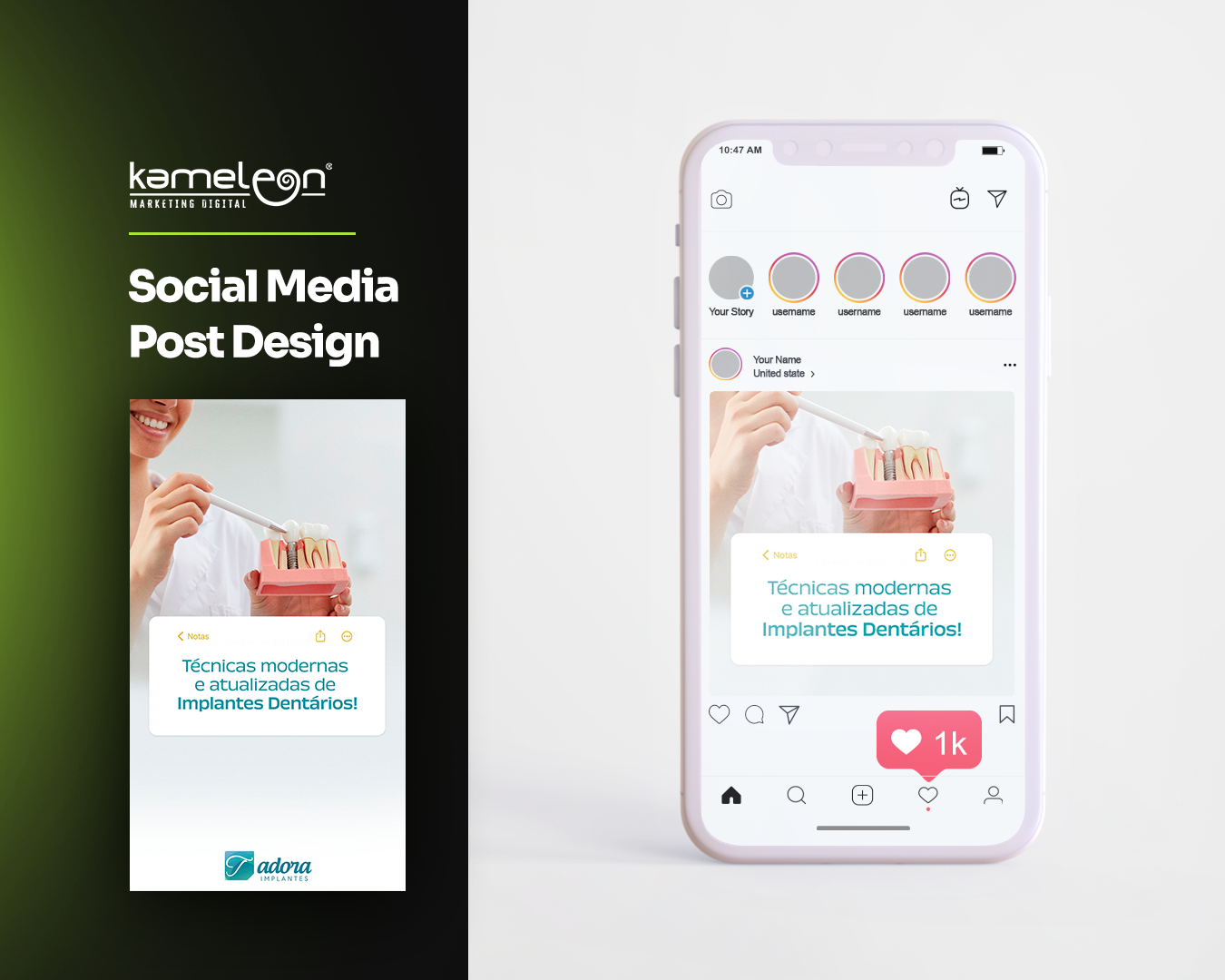 Portfólio Adora Odontologia Kameleon Marketing Digital